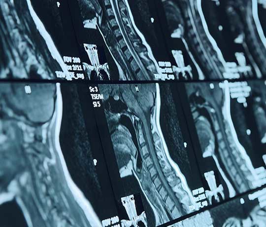 Neuroradiology scan