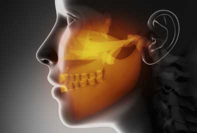 Chronic jaw pain requiring corrective jaw surgery