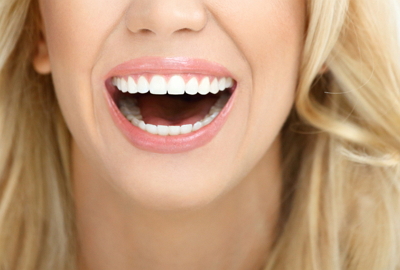 Patient displaying dental veneer results of white, perfect teeth with a smile